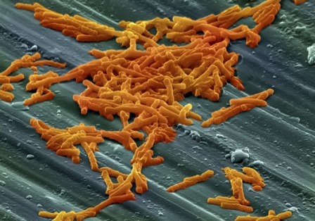 Ανθεκτικά στελέχη του Clostridium difficile «λυμαίνονται» τα νοσοκομεία